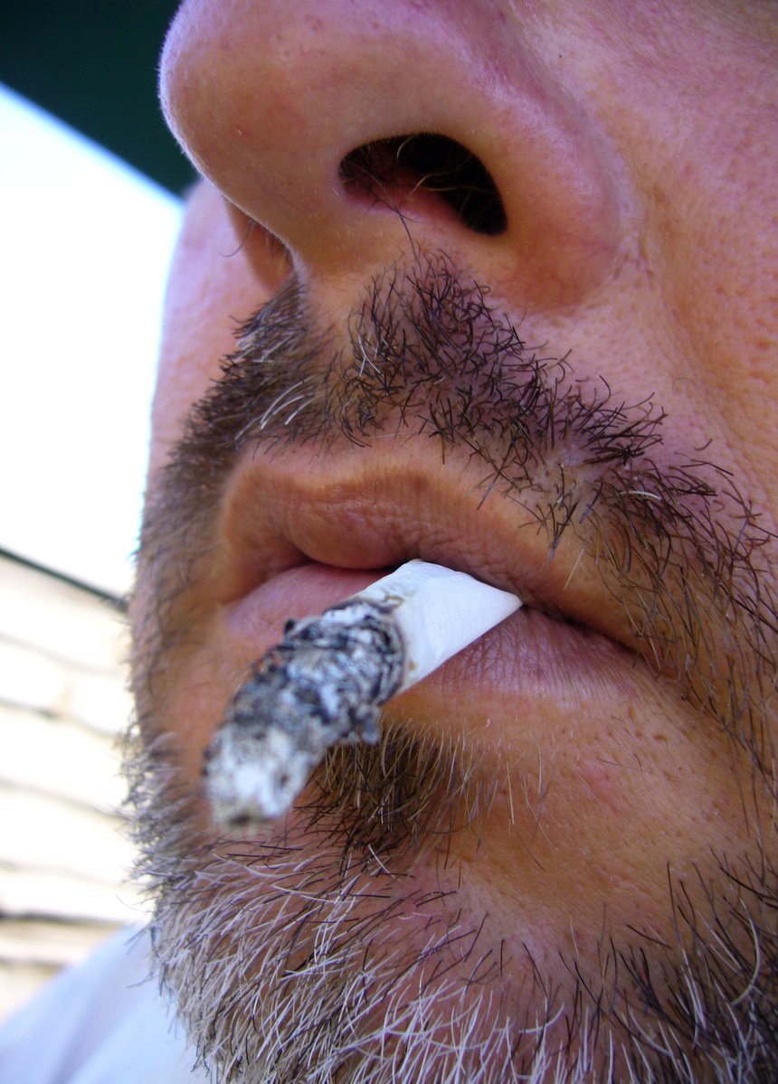 a bearded man with an area around his lip is smoking a cigarette