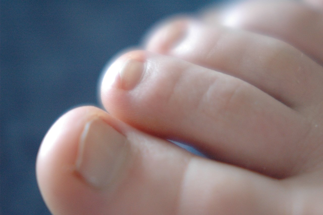 a close - up s of a person's feet and toe