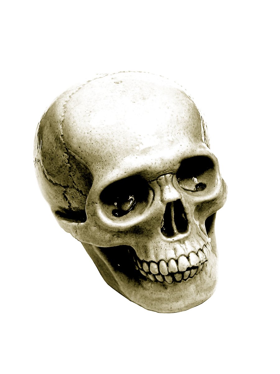 an old black and white pograph of a skull with a missing jaw