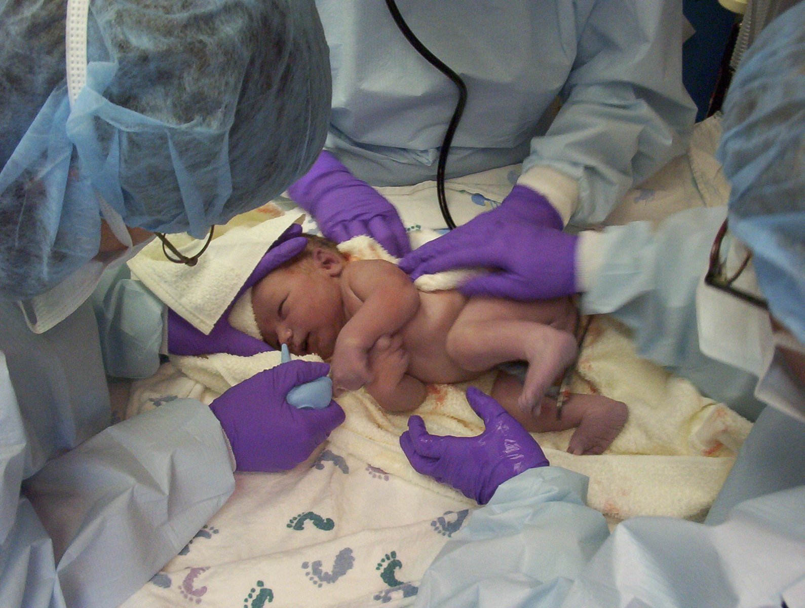 a baby who is in the hospital hooked up to a nurse