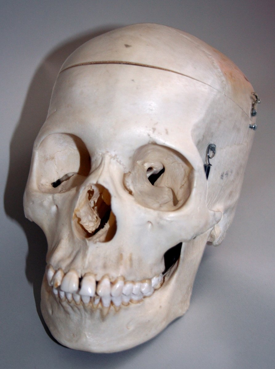 a human skull has been carved and put in place