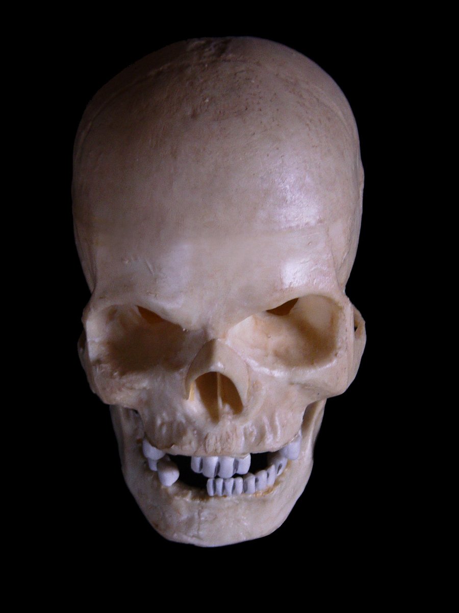 a large human skull with the teeth exposed