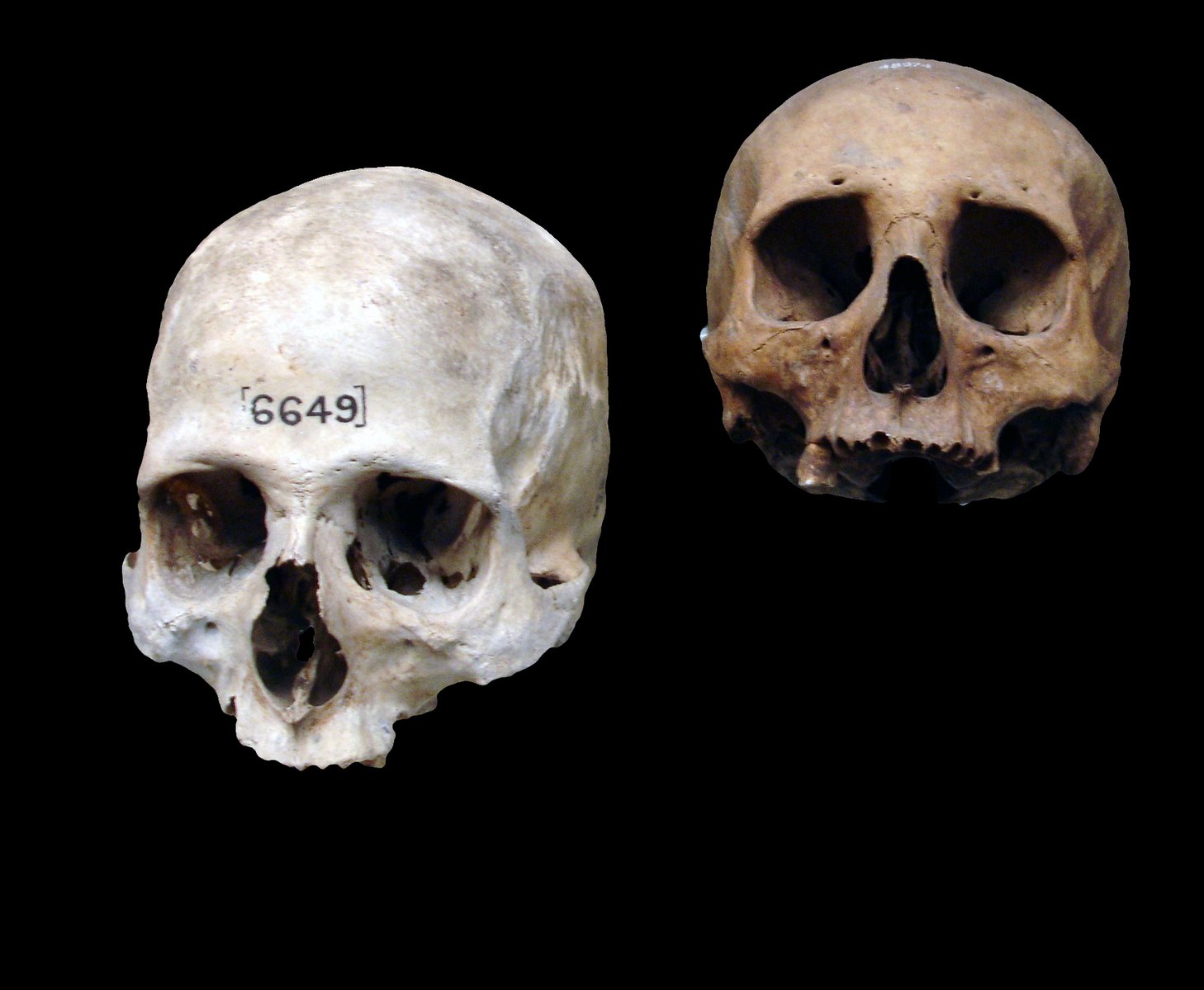 two images of the bones of a baby skull and a skeleton with words inscribed in their skulls