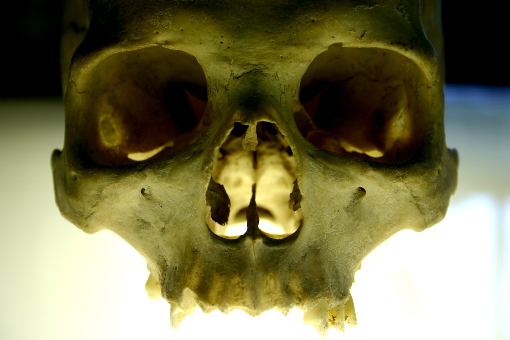 a human skeleton has a lower jaw and middle part