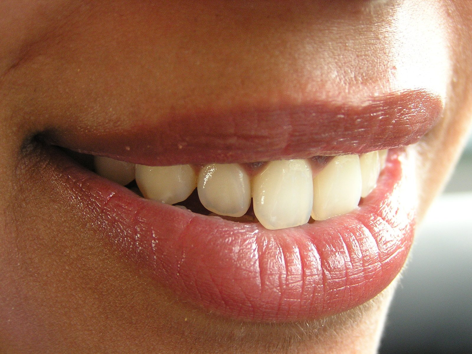 a woman has a smile with teeth in it