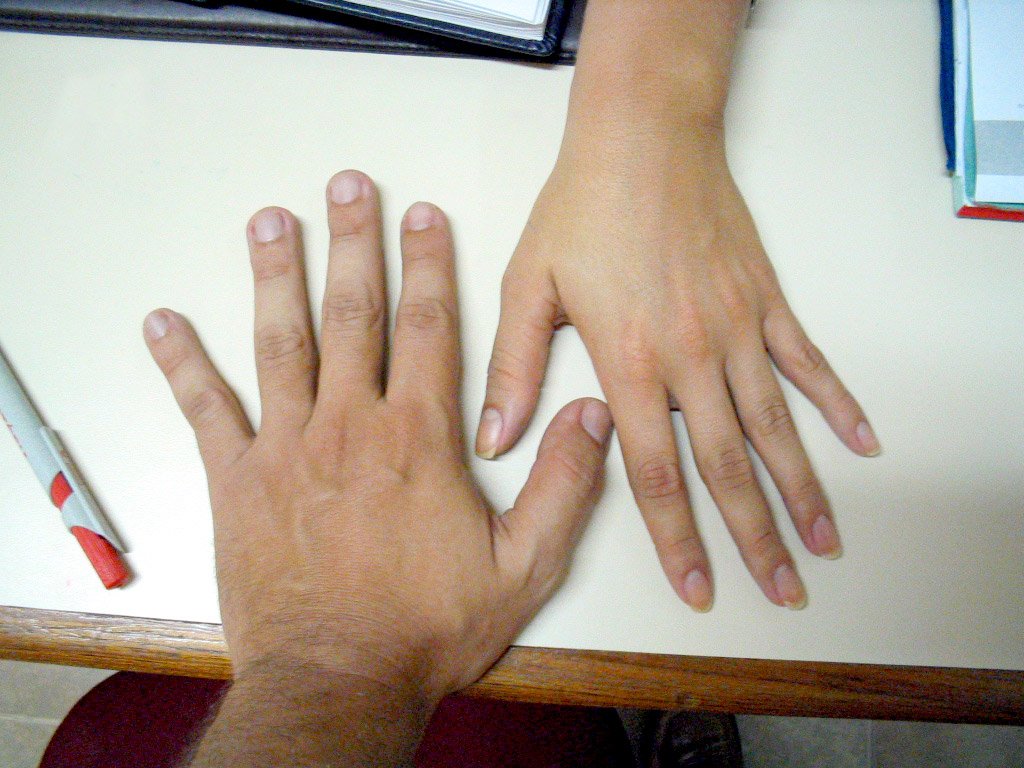 a person has their arm in a hands down with both hands touching the desk