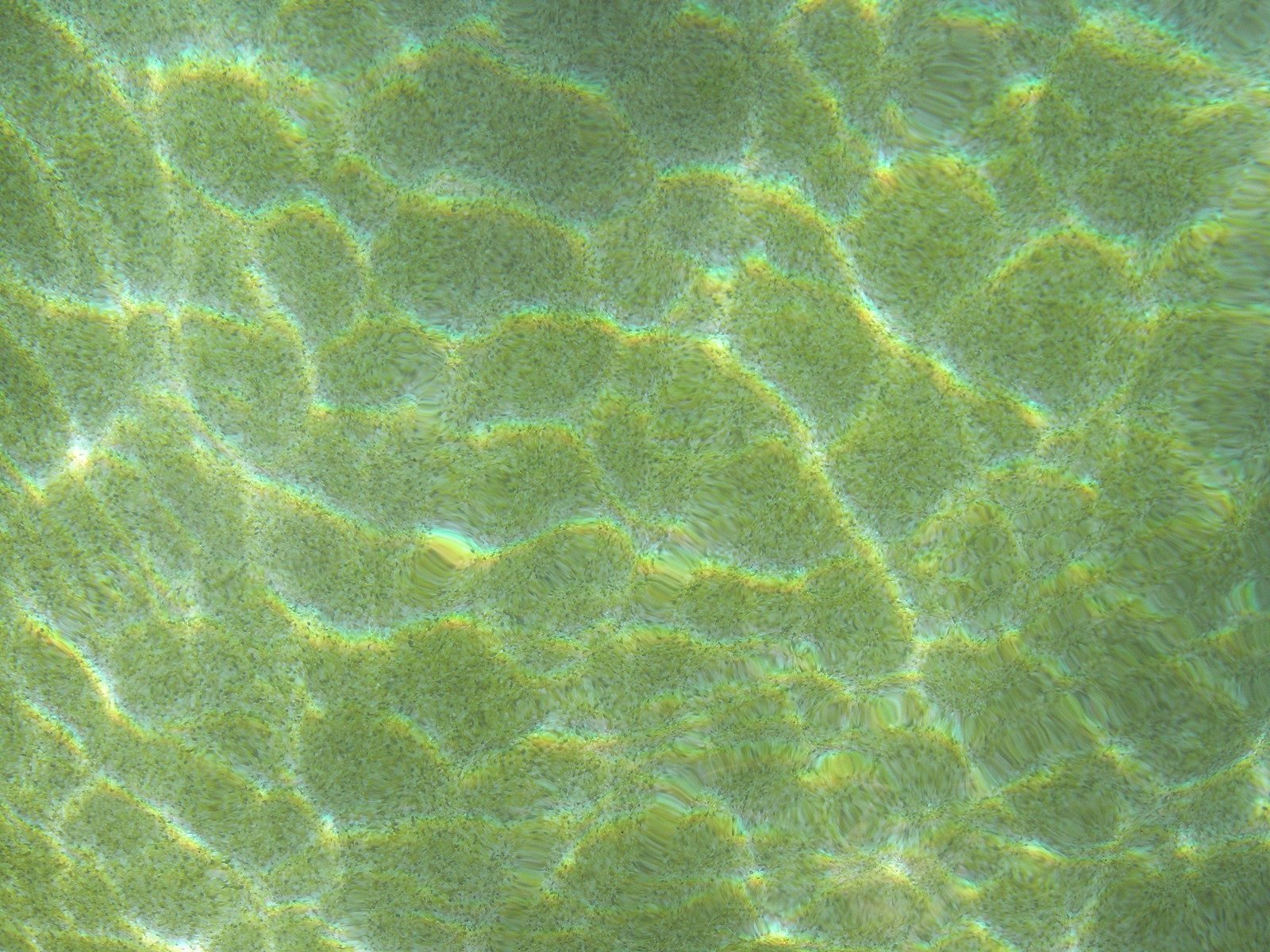 green algae floats in water, beneath a microscope lens