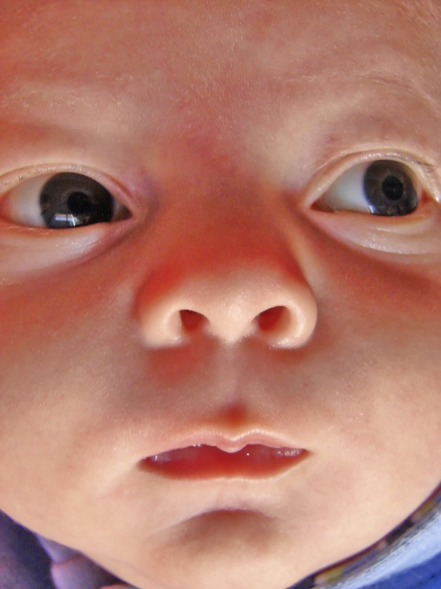 an infant's nose and eyebrows is seen close to the camera