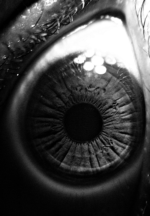 a closeup of the eye with drops on it