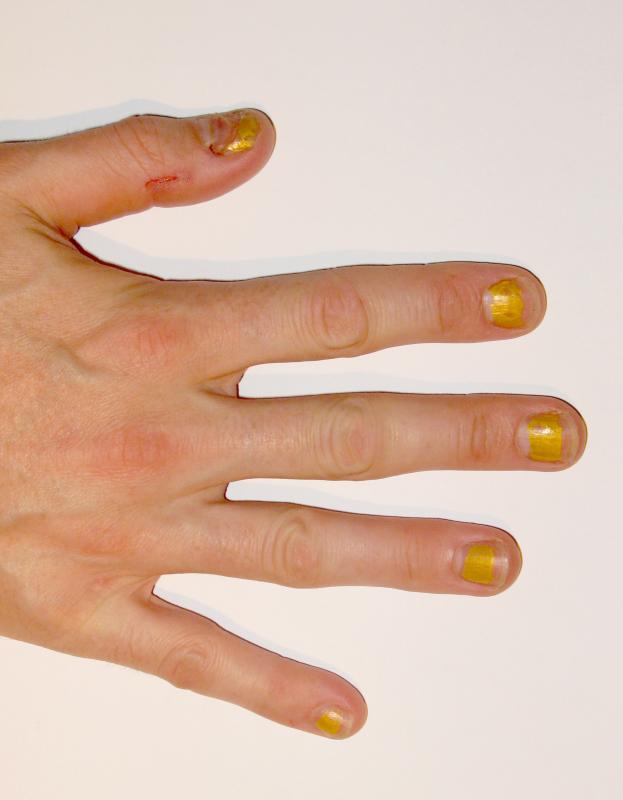a hand has a yellow and white manicure