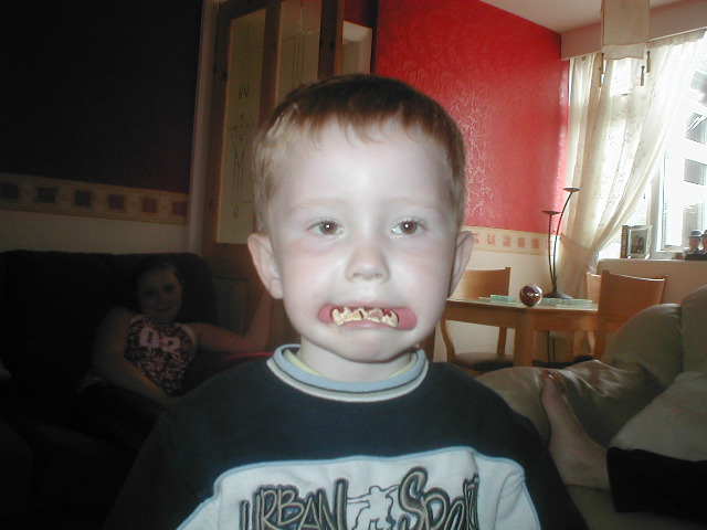 small boy with gold teeth at home on the sofa