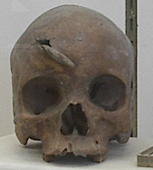 an old, worn skull sits on a table in front of a box with some small scissors