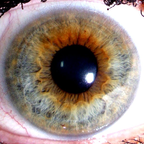 an image of an eye with a dark circle inside