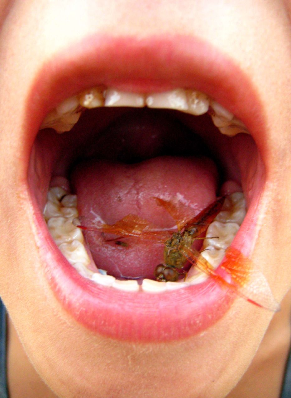 a person's open mouth with a bug on their tongue