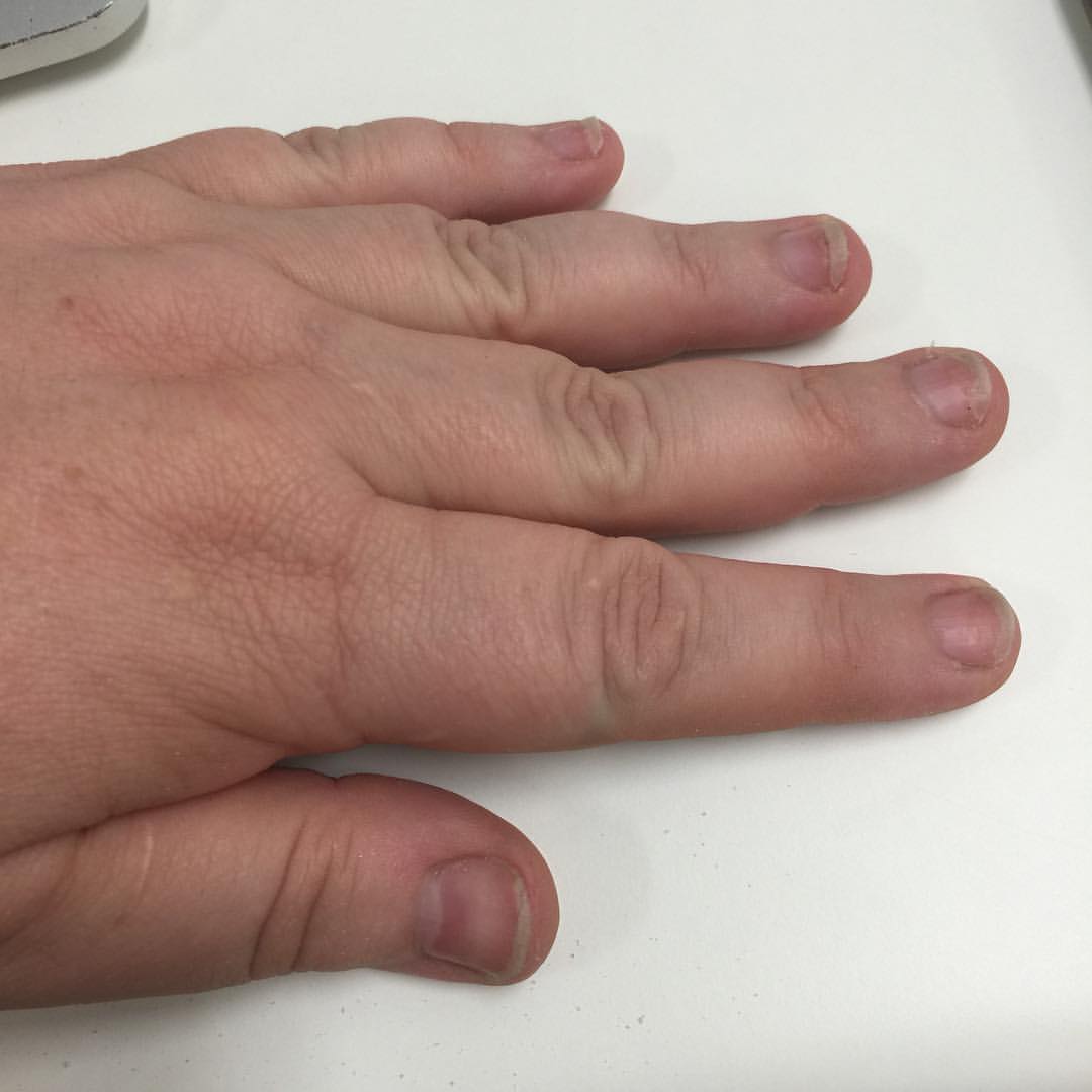 a hand resting on a computer desk with two fingers