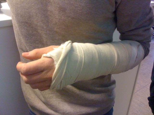 a person with bandaged arm and elbow holding soing