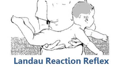 picture of manual for ladau reaction reflex