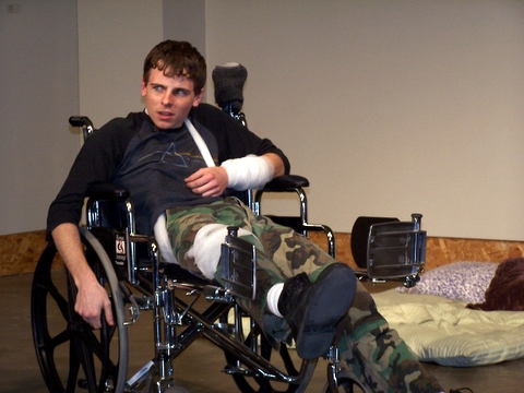 a man with injured legs sitting in a wheel chair