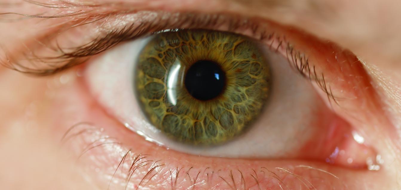 an image of a green eye with one small patch of iris
