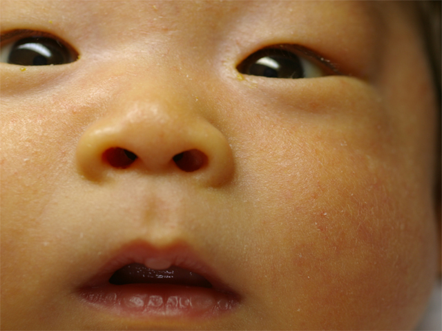 an close up of a baby's nose with only one eye