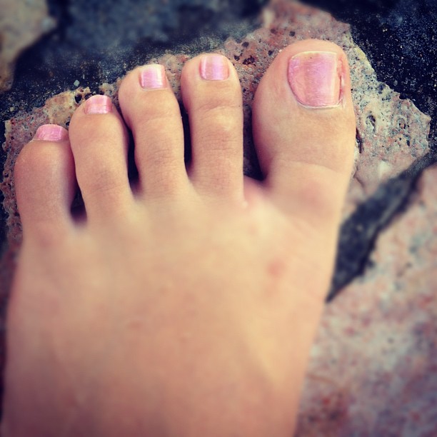a pinkish po shows the right toe and the left foot