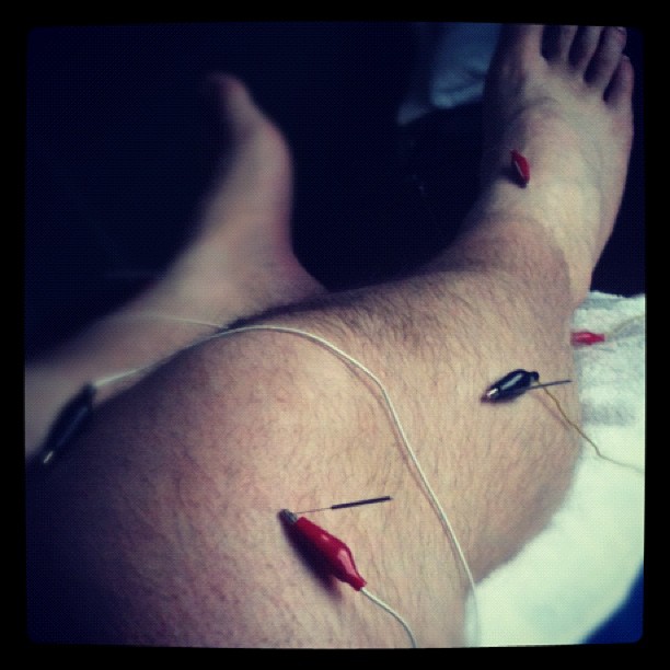 the legs are being hooked up with a string