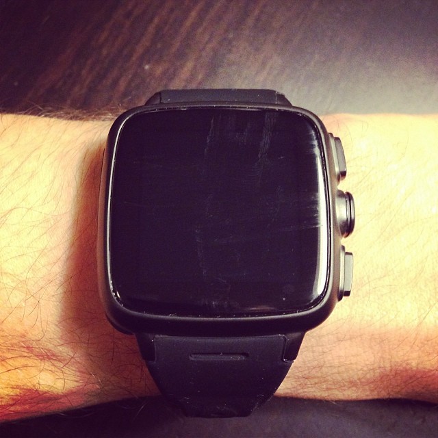 the wrist has a smart watch on it