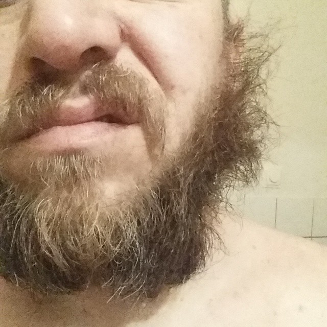 man's face and beard with small amount of skin