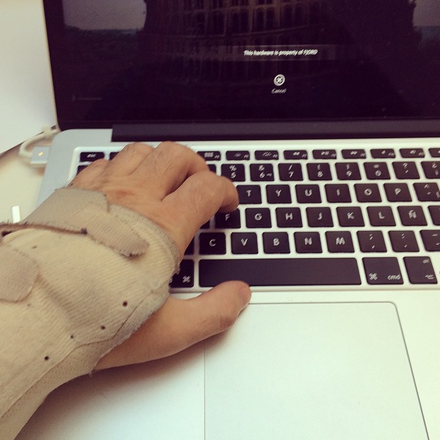 there is a person with cast on their hand typing on a laptop