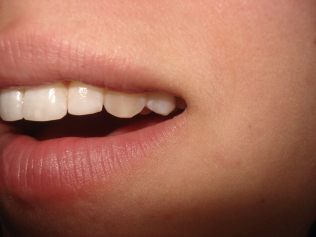 close up view of a smile in a child's mouth