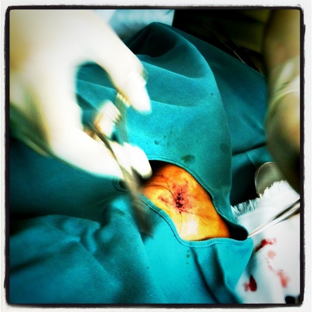 an image of a surgical procedure doing  on a patient's arm