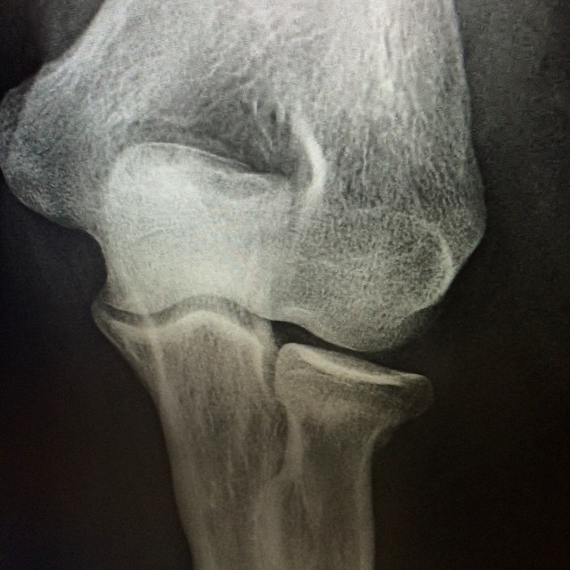 an x - ray image shows a large joint on the leg