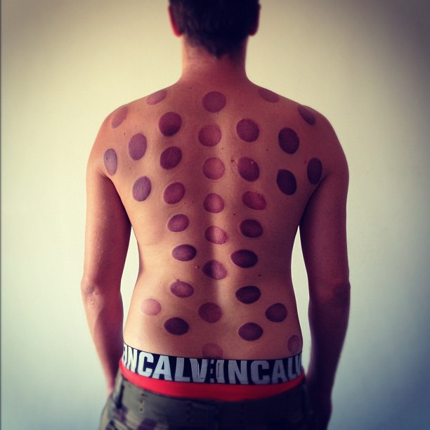 a man with spots on his back and his words all over him