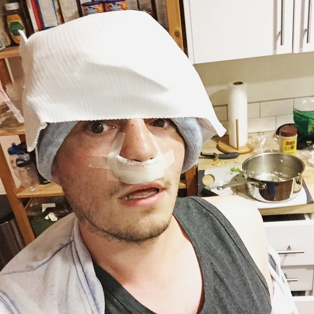 man with a plaster taped to his nose in the kitchen