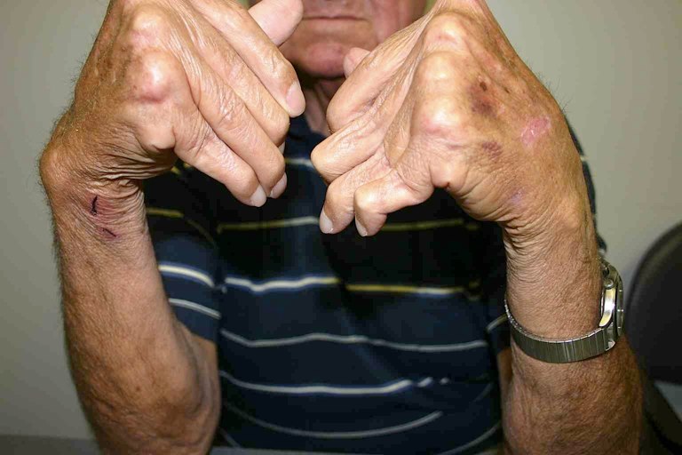 a man with black hands with an ont he end pointing down