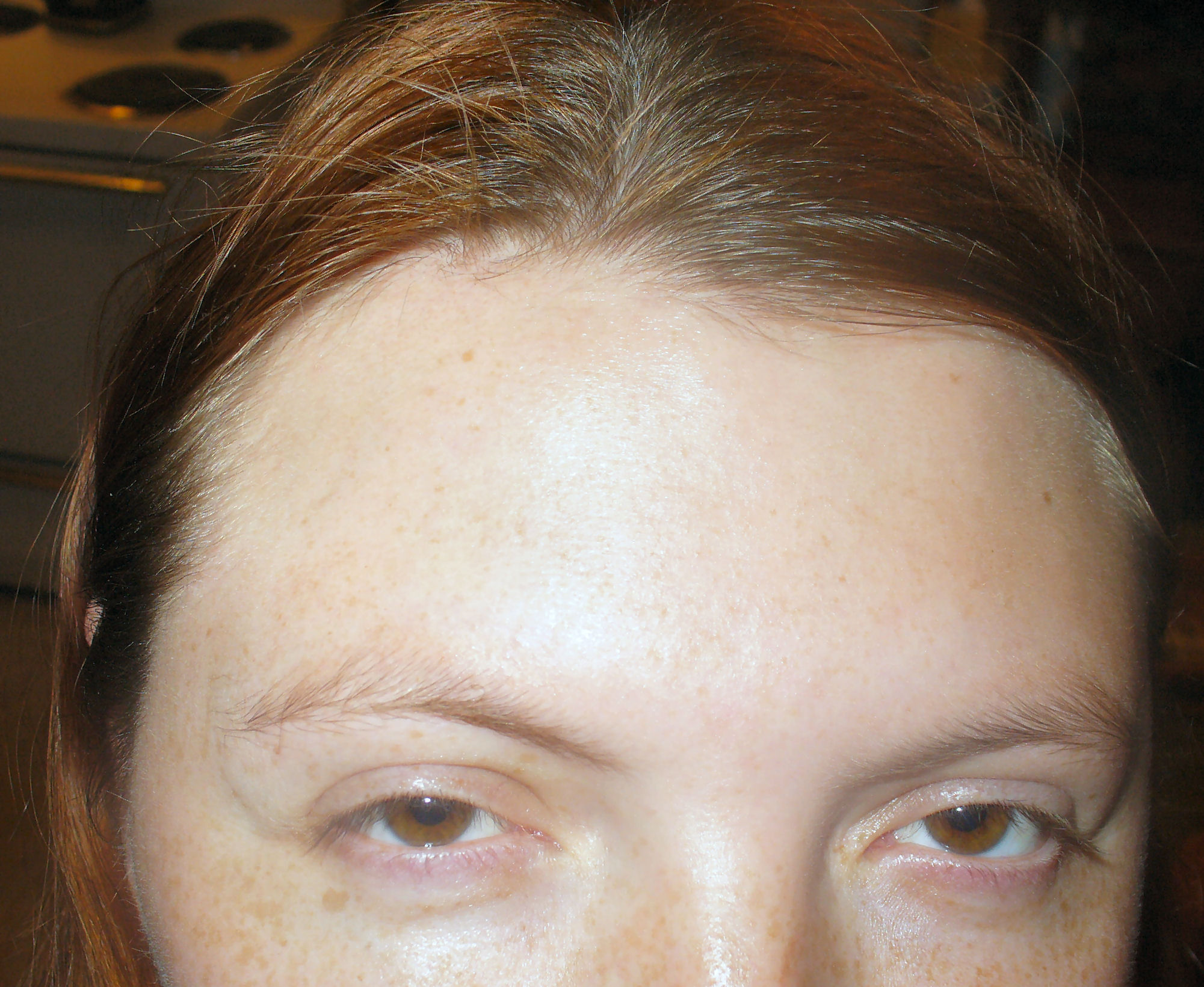 a woman with freckles on her face and eye