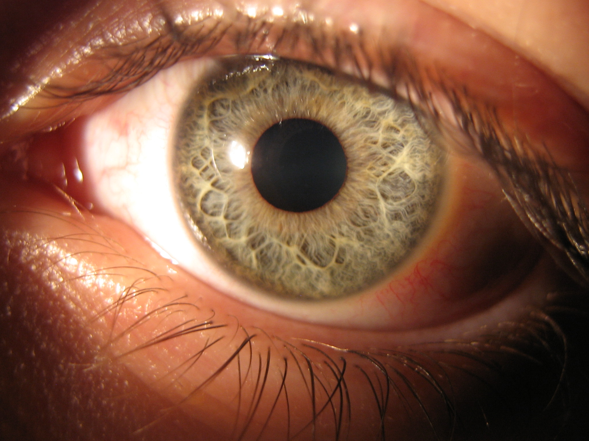 an eye has a light blue circle, and the iris is visible