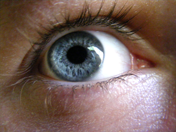 a close up of a eye with a dark circle around it