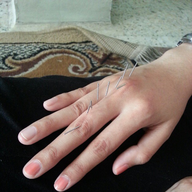 a women is holding on to her nails with some sharp needles in each hand