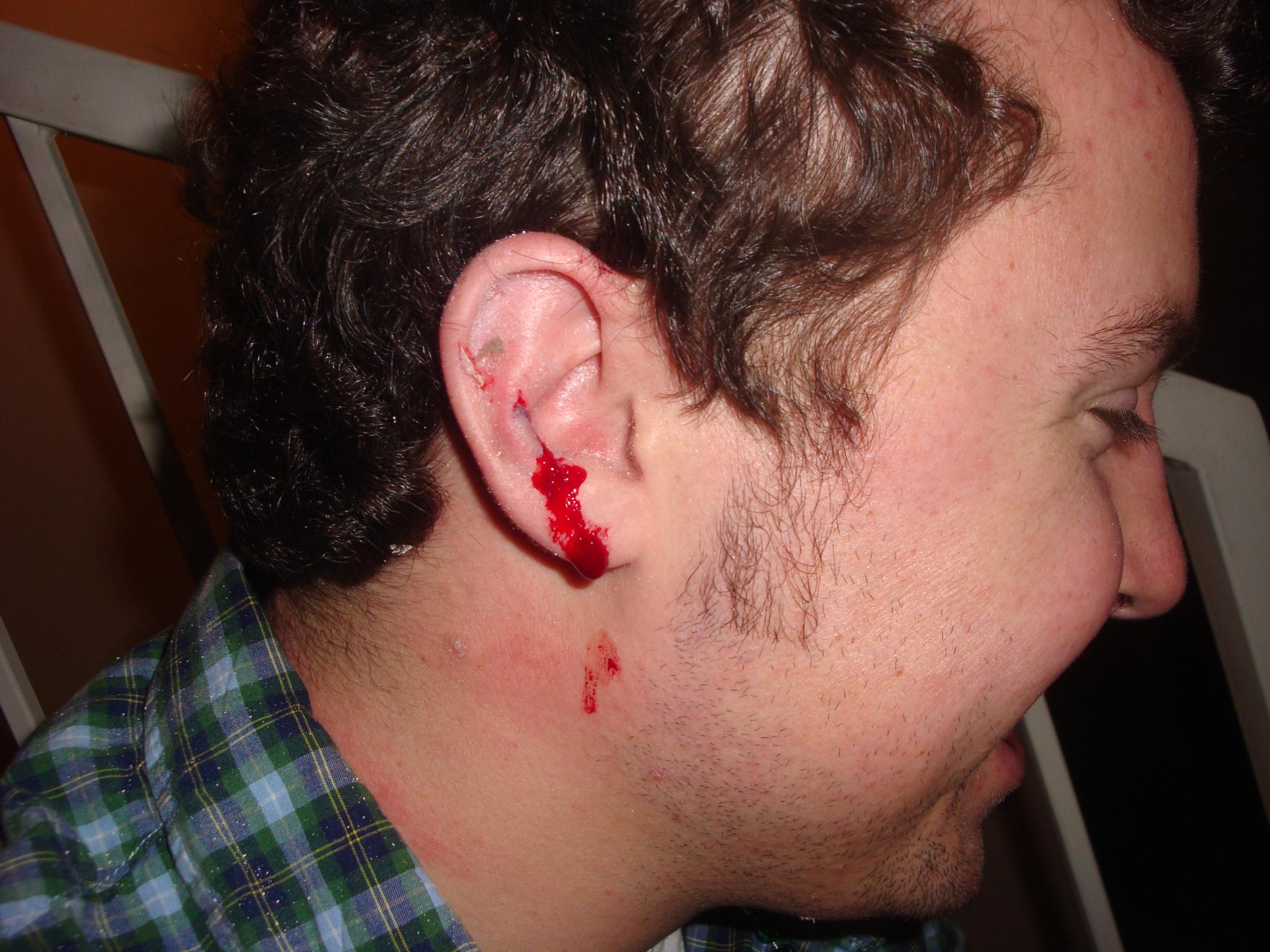 a close up view of a man with a bleeding ear