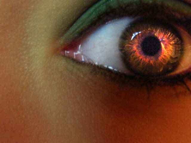 an eye showing an iridescent red color