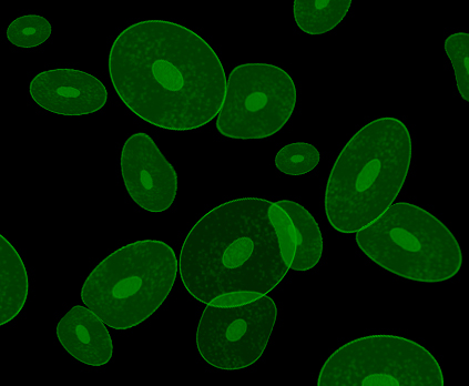green algae under the microscope with their bubbles