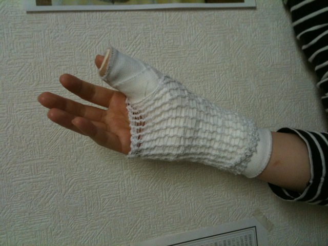 someone with their hand in a knit armwarming