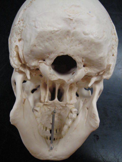 a view of the frontal view of a skull