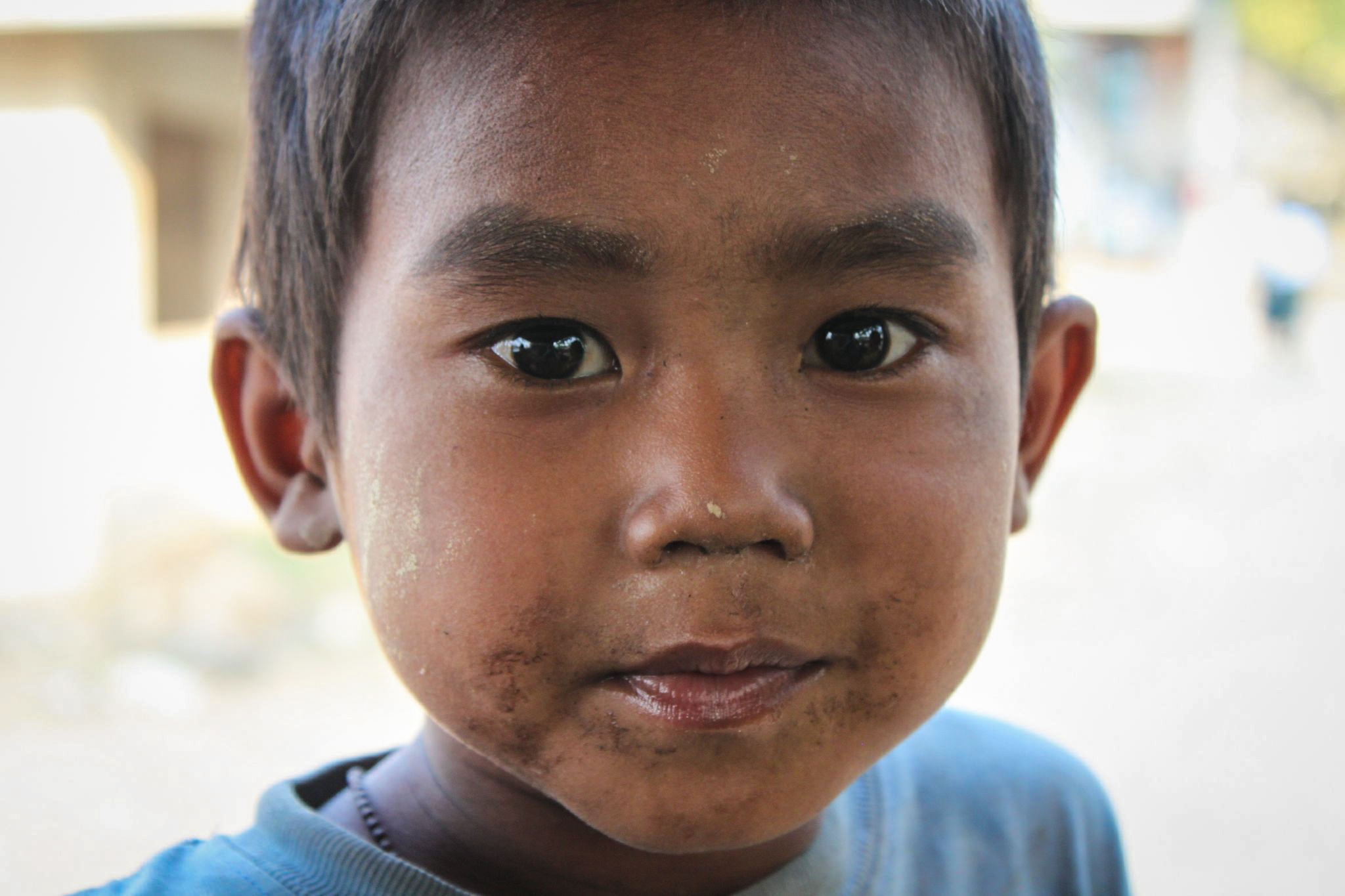 the head of a boy with large brown eyes