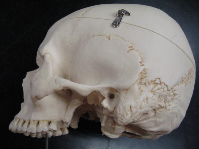 a medical model shows the human head and skull bones