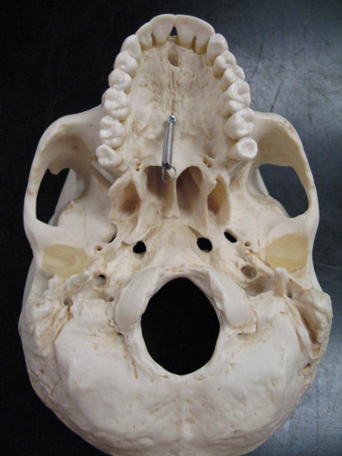 there is a picture of a human skull showing the venapopterye