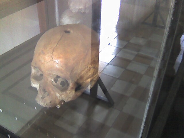 a dead skull is displayed in a glass case