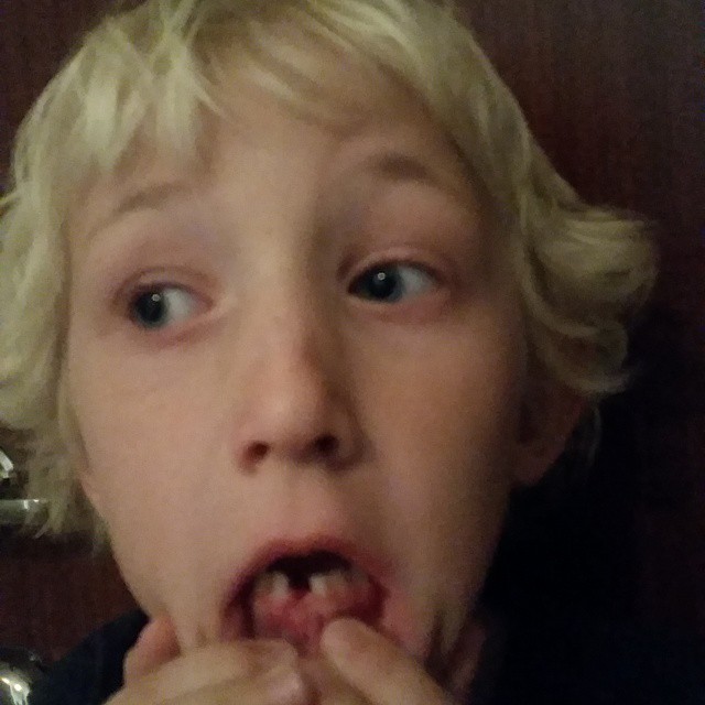 a boy holds his hands together while putting soing into his mouth