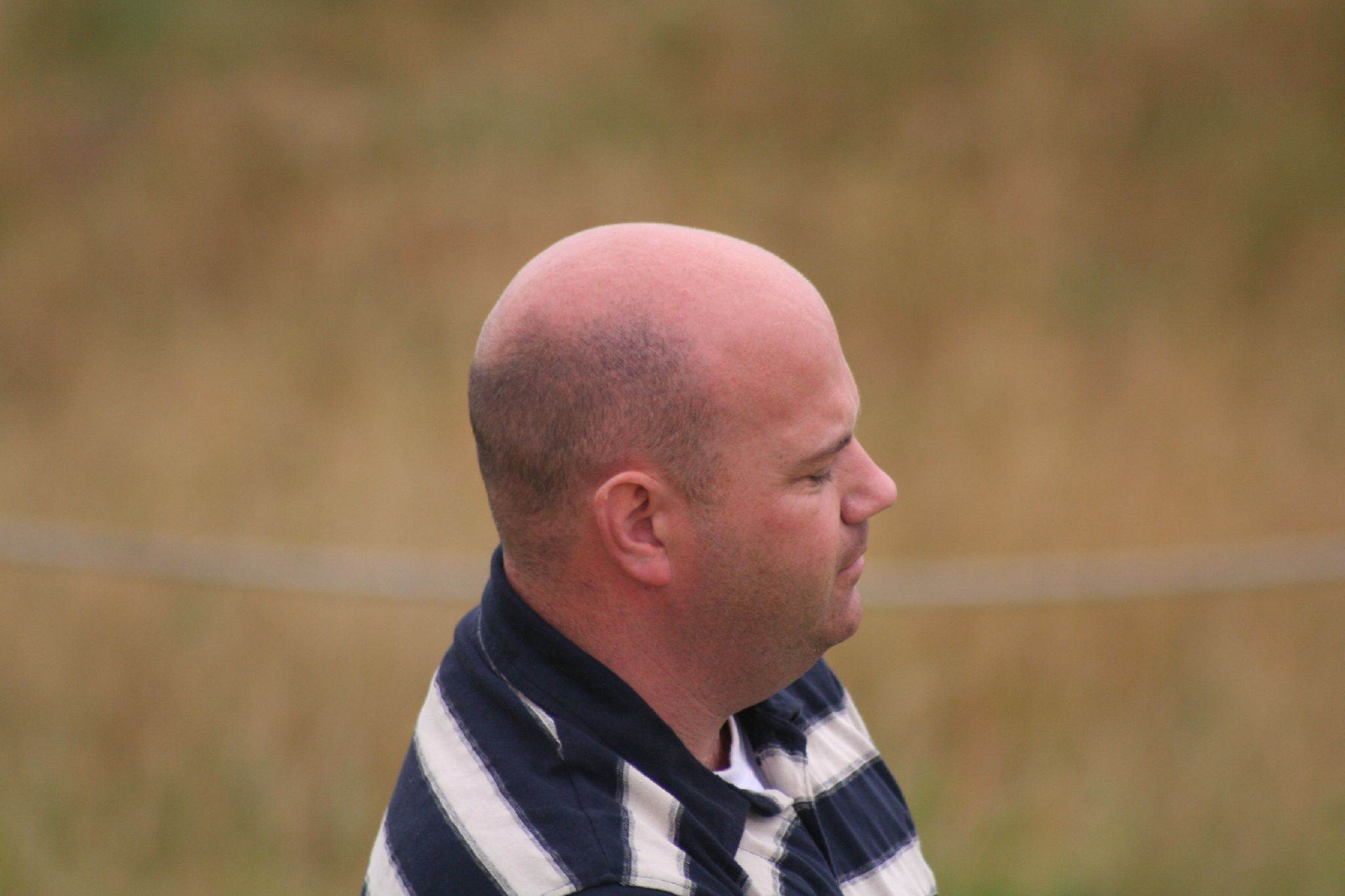 a bald head male wearing striped shirt looking away